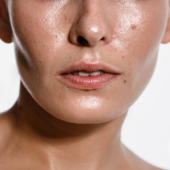 Oily Skin